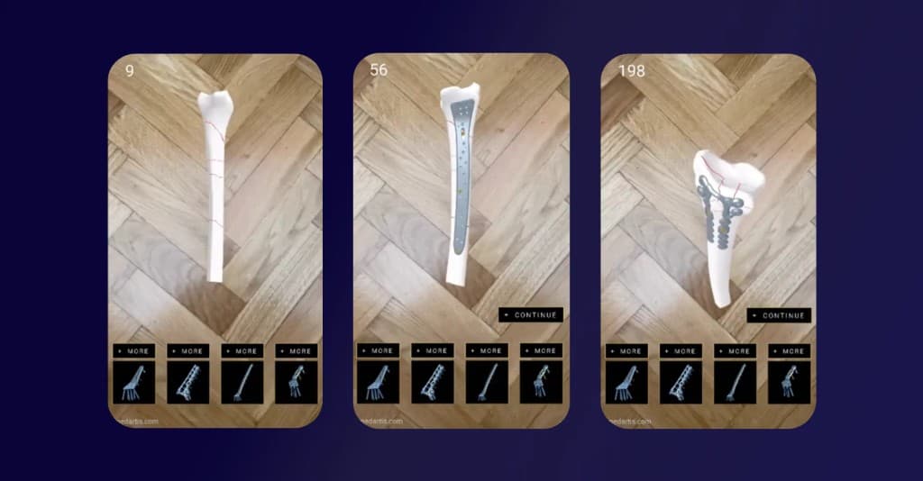 Medical AR Experience for Medartis Surgical Plates